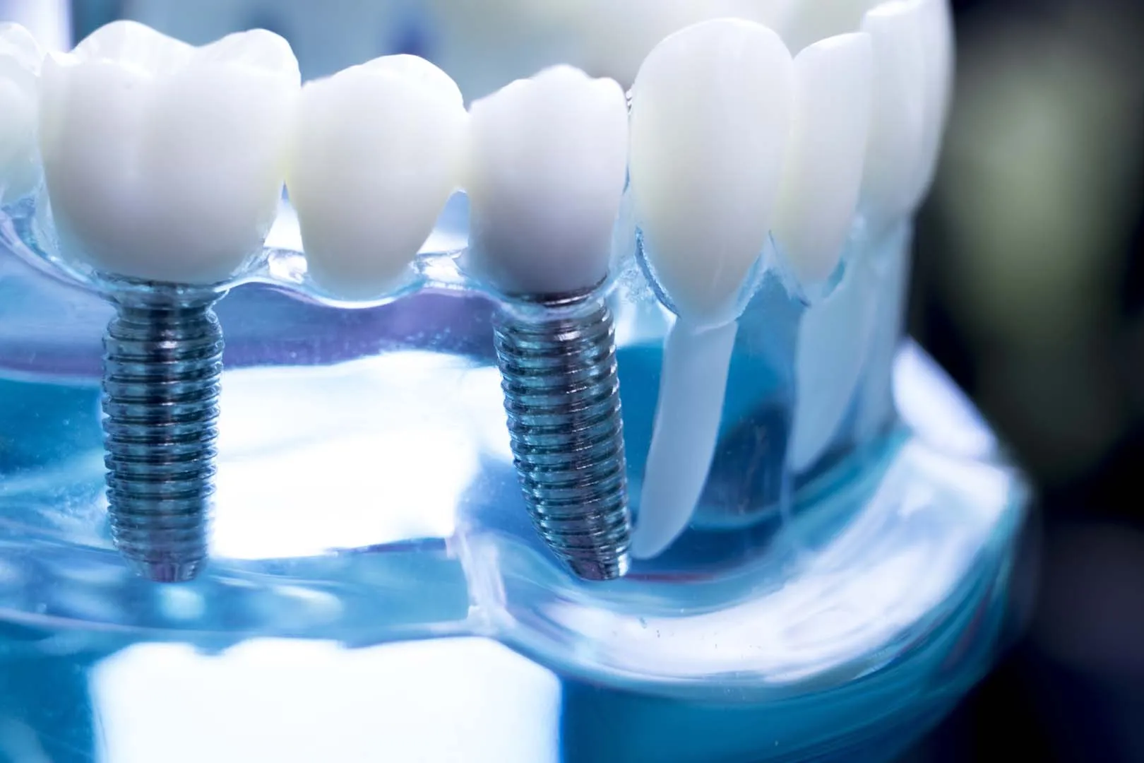 General Dentistry